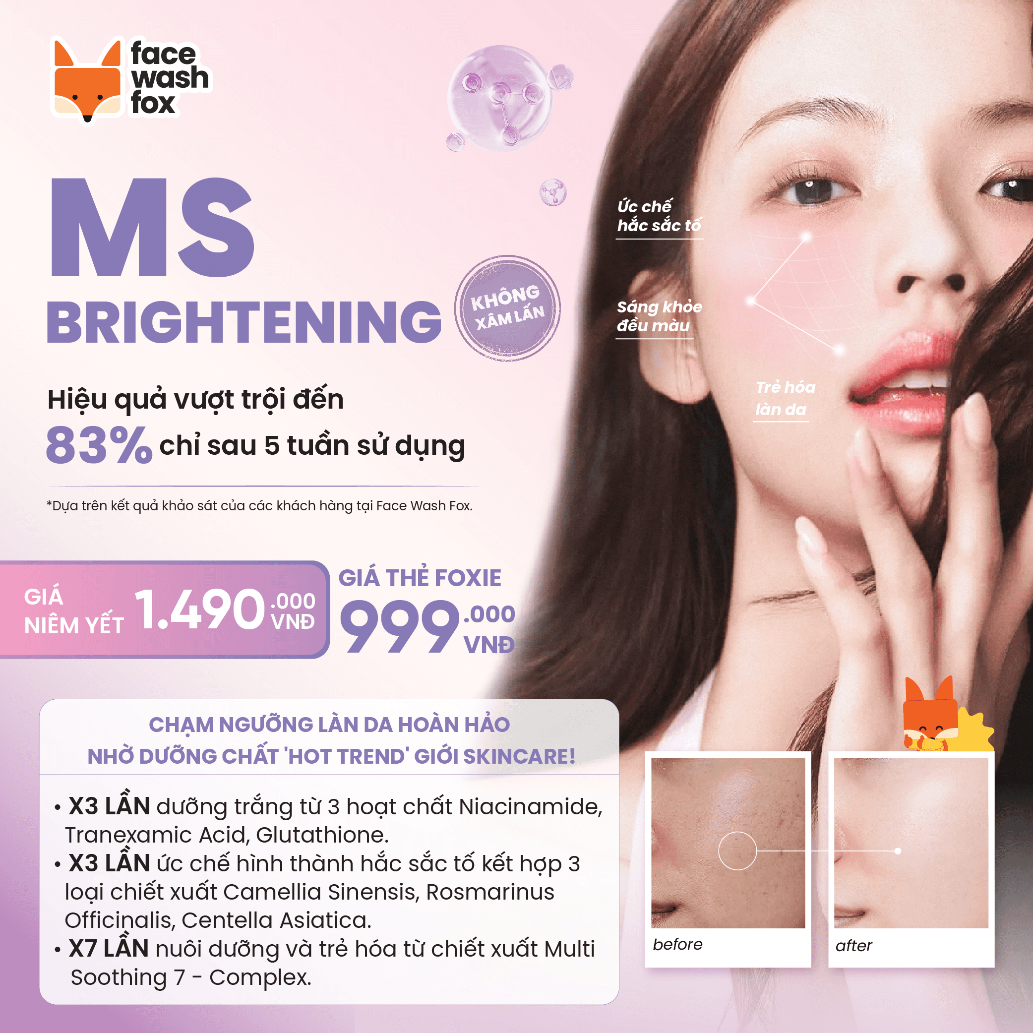 MS brightening